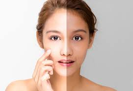 Glass Skin Glow: The Korean Brightening Skincare Revolution in 2025