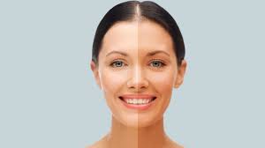 Hyperpigmentation Solutions: Korean Skincare for Dark Spots in 2025