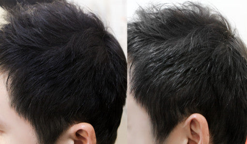 Daily Anti-Hair Loss Fixer Mist 120ml, DASHU DASHU Hair Tonic
