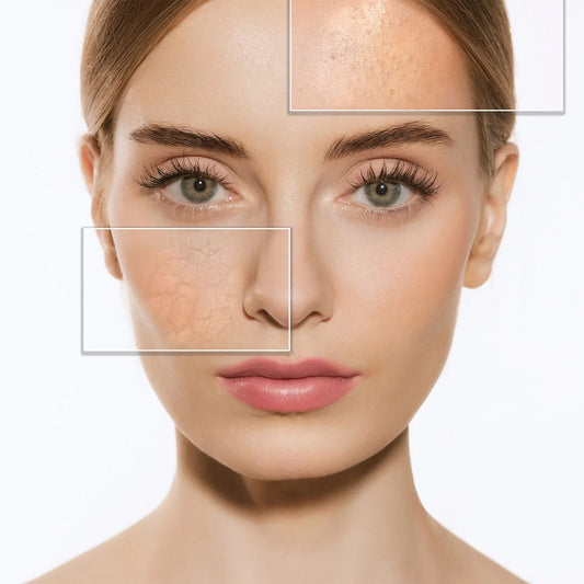 Korean Skincare for Combination Skin – How to Balance Oily and Dry Areas Naturally