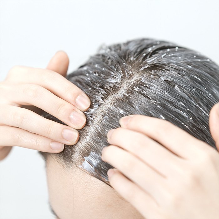 Why SparkleSkin K-Beauty Is Your Destination for the Best Korean Hair Care